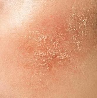 Pigment & Tone Correction