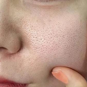 Pigment & Tone Correction